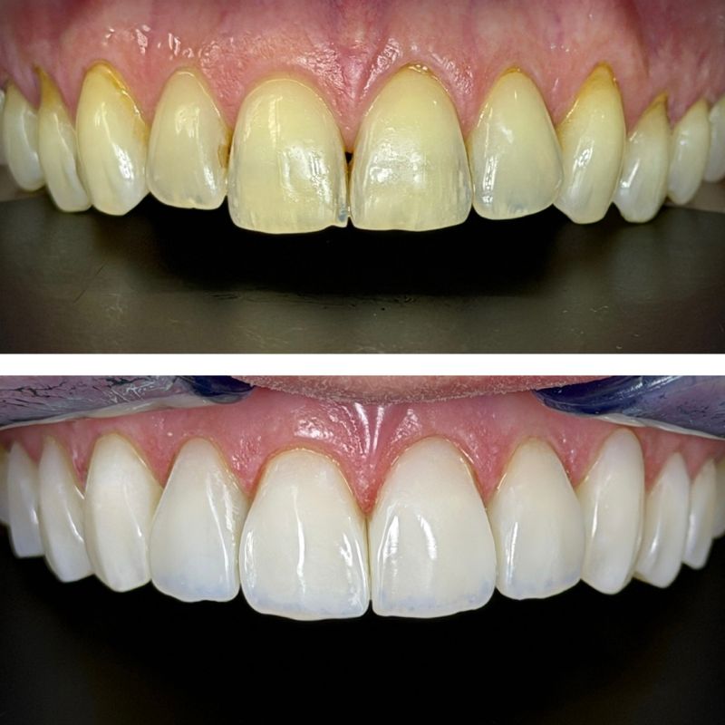 Before and After 6