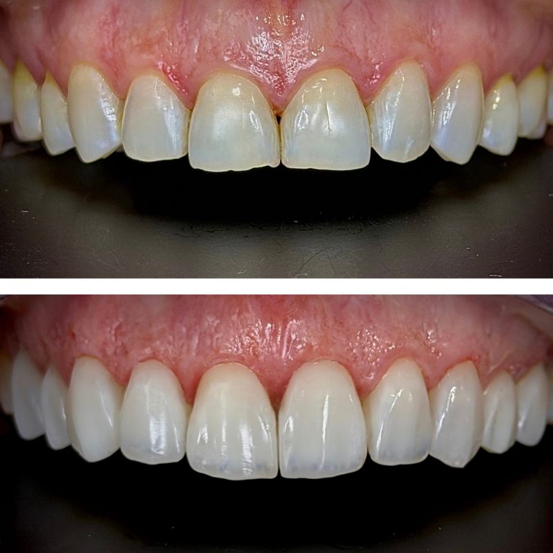 Before and After 9
