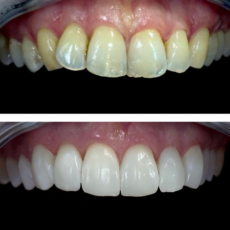 Before and After 10