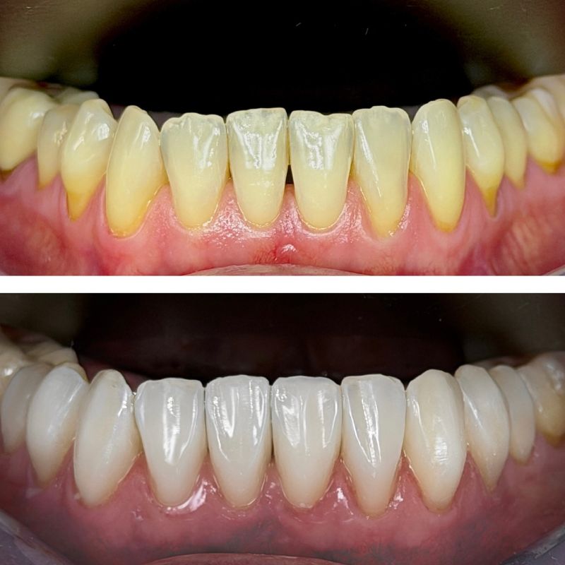 Before and After 7