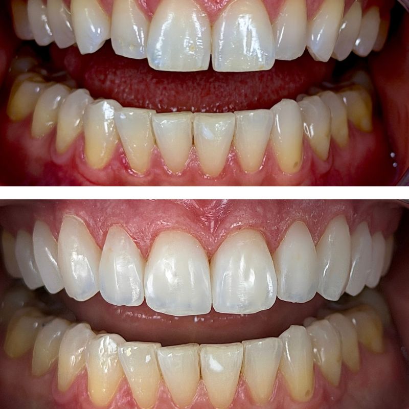 Before and After 19