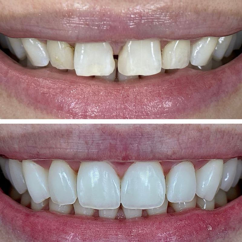 Before and After 22
