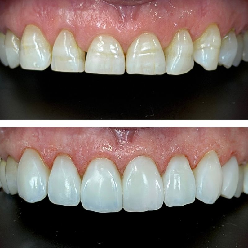 Before and After 8