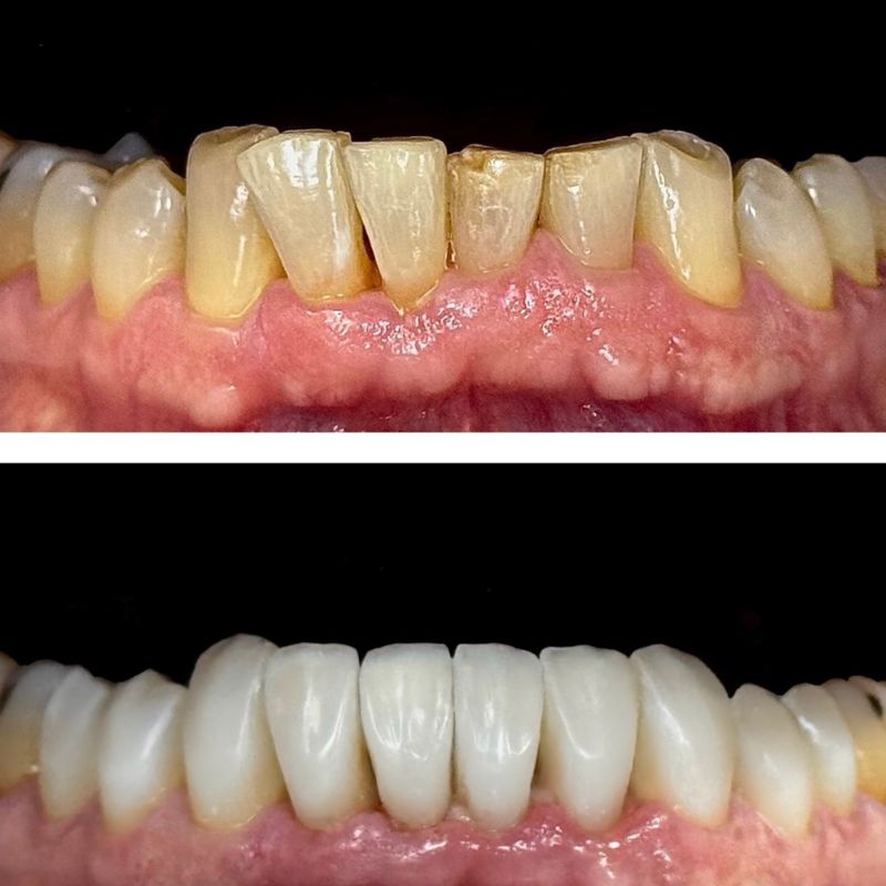 Before and After 12