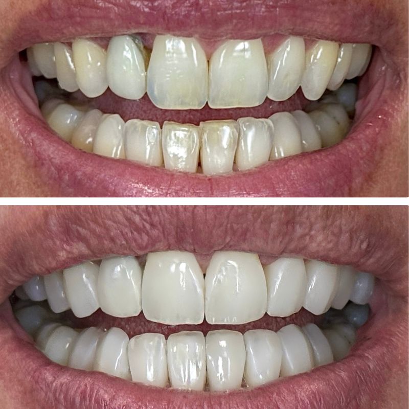 Before and After 24