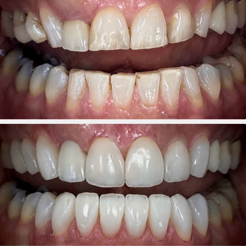 Before and After 14