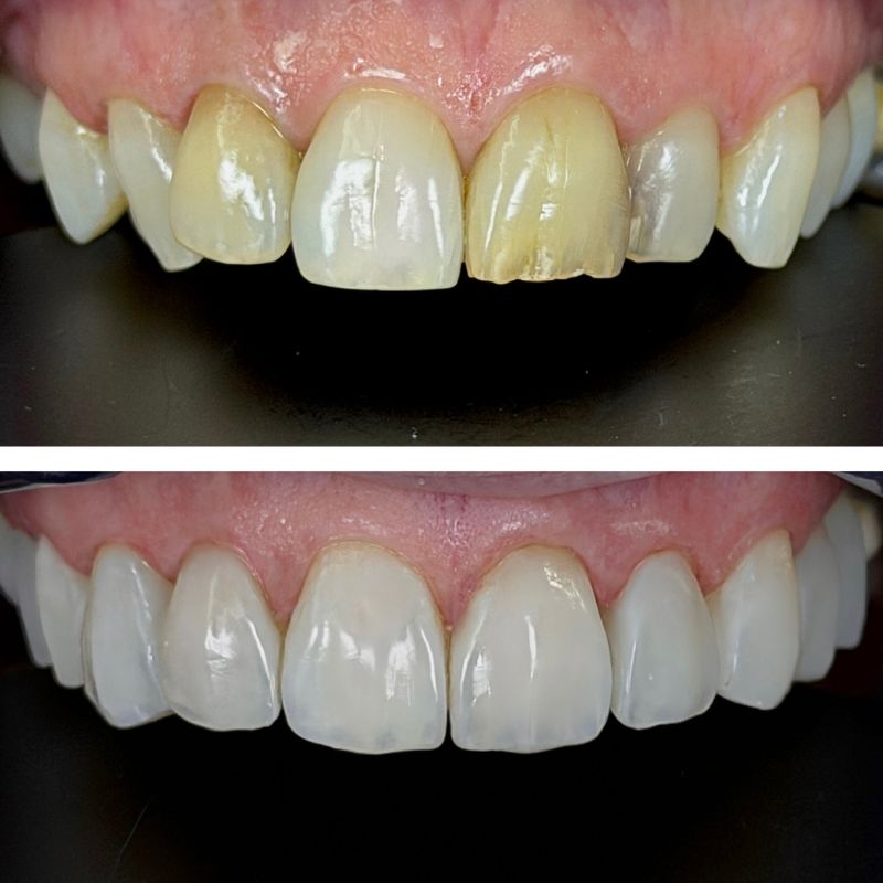 Before and After 3