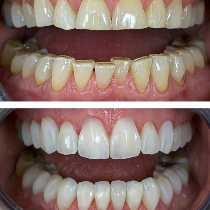 Before and After 4