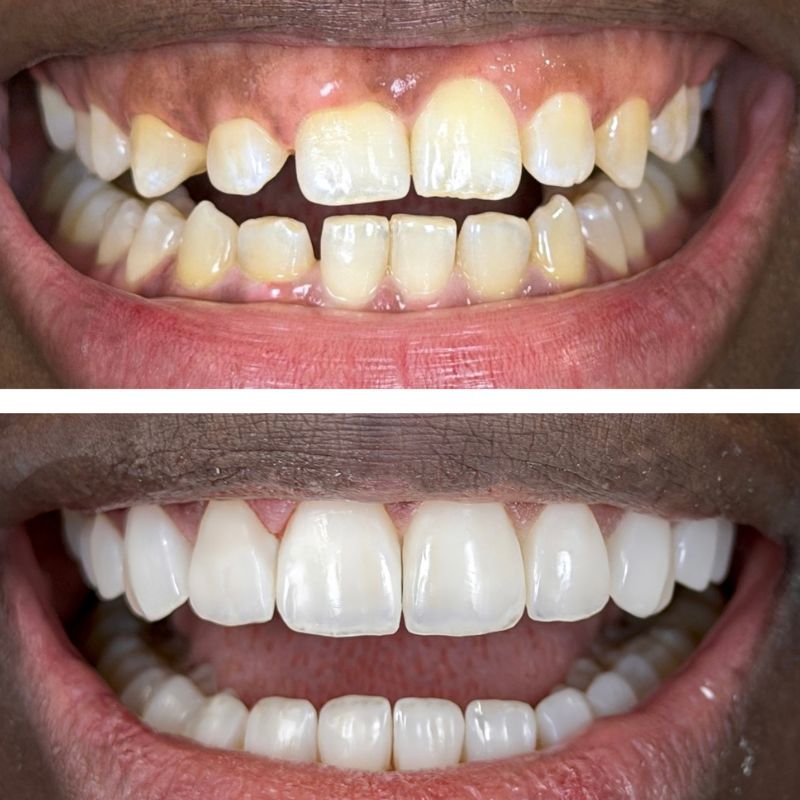 Before and After 23