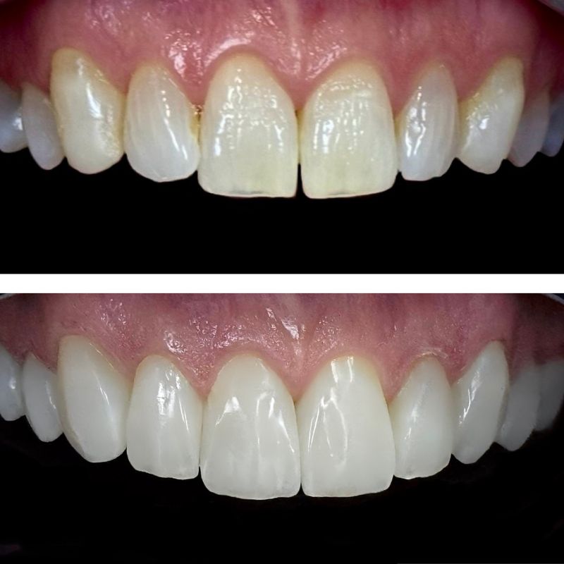 Before and After 16
