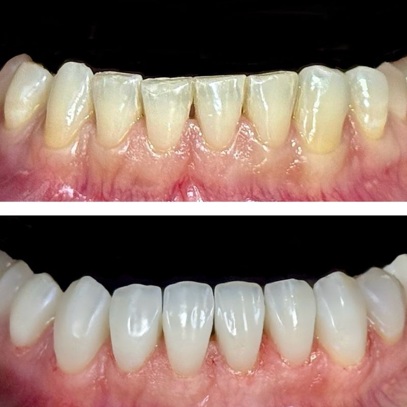 Before and After 1