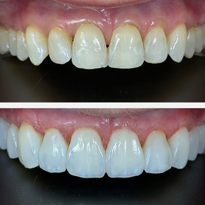 Before and After 18