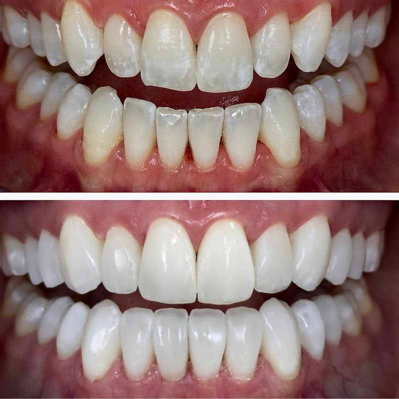 Before and After 17