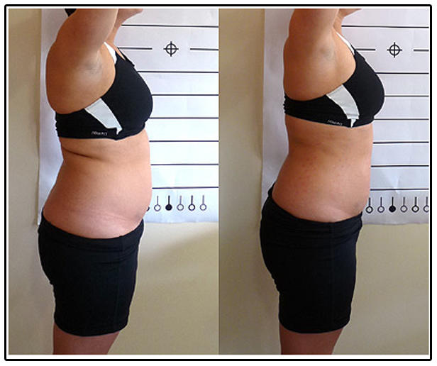 Patient Result 4