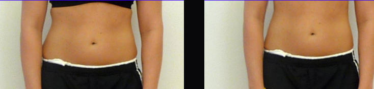 Patient Result 2