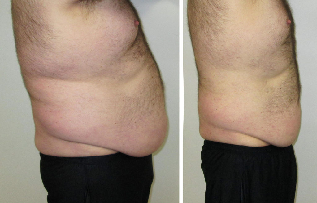 Patient Result 3