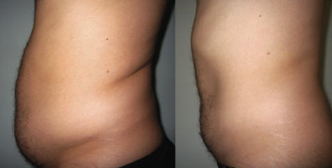 Patient Result 5