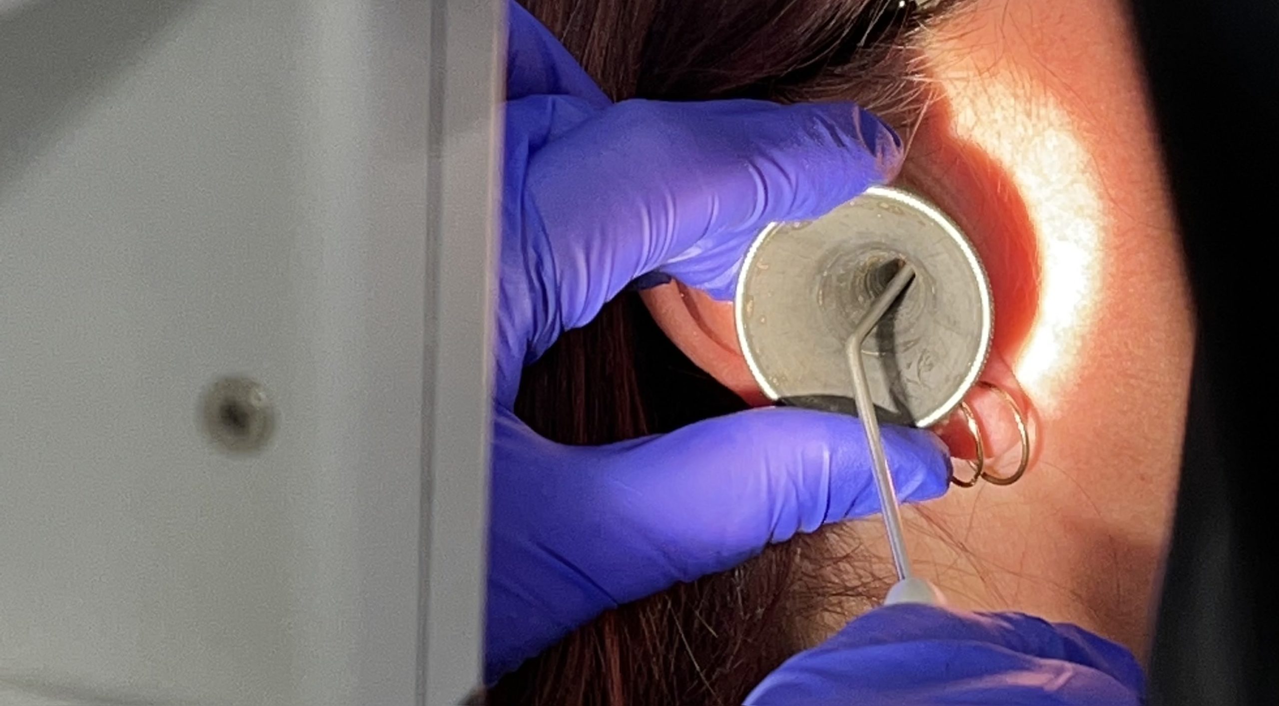 Ear microsuction procedure