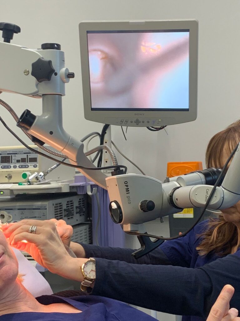 This is microsuction. To be done properly requires expensive equipment.