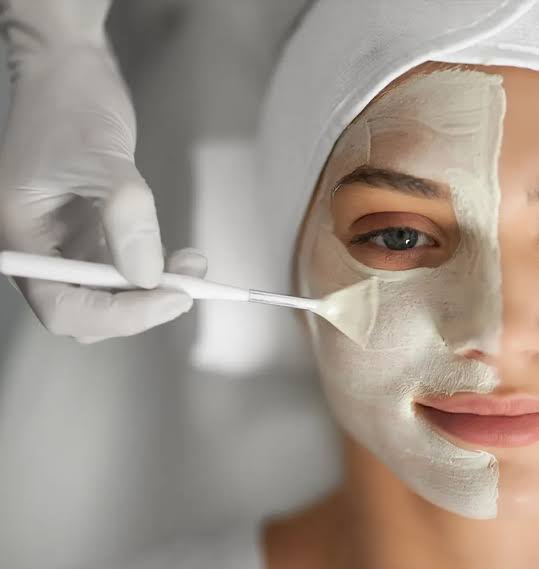 Peeling Químico