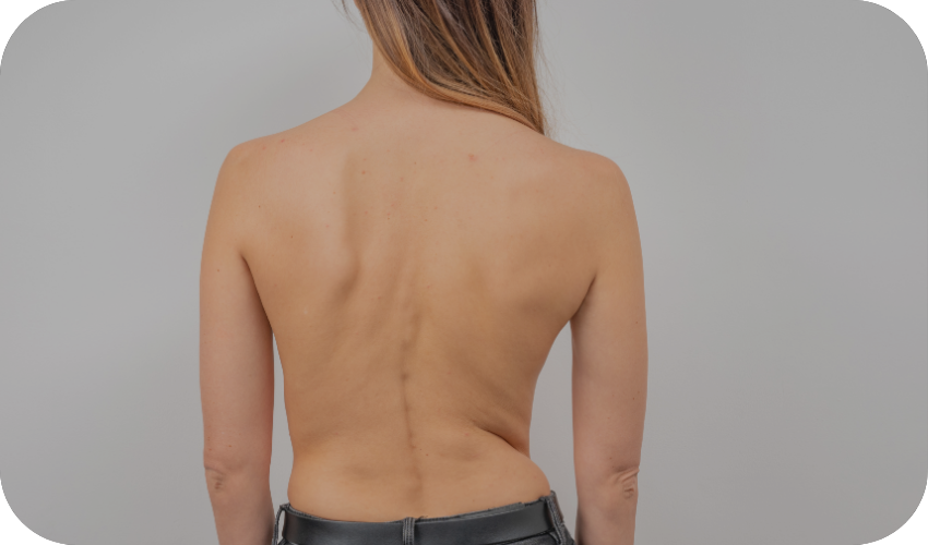Back Skin Tightening in Mississauga
