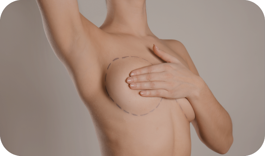 Non-Surgical Breast Lifting at Body Empire Mississauga