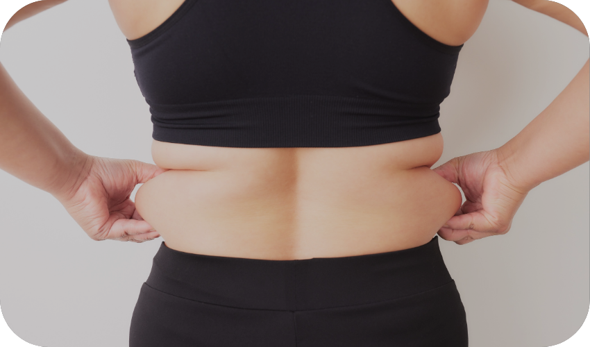 Back fat melting and bra roll removal treatment at Body Empire Mississauga
