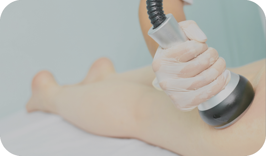 Ultrasonic cavitation fat reduction treatment at Body Empire Mississauga MedSpa