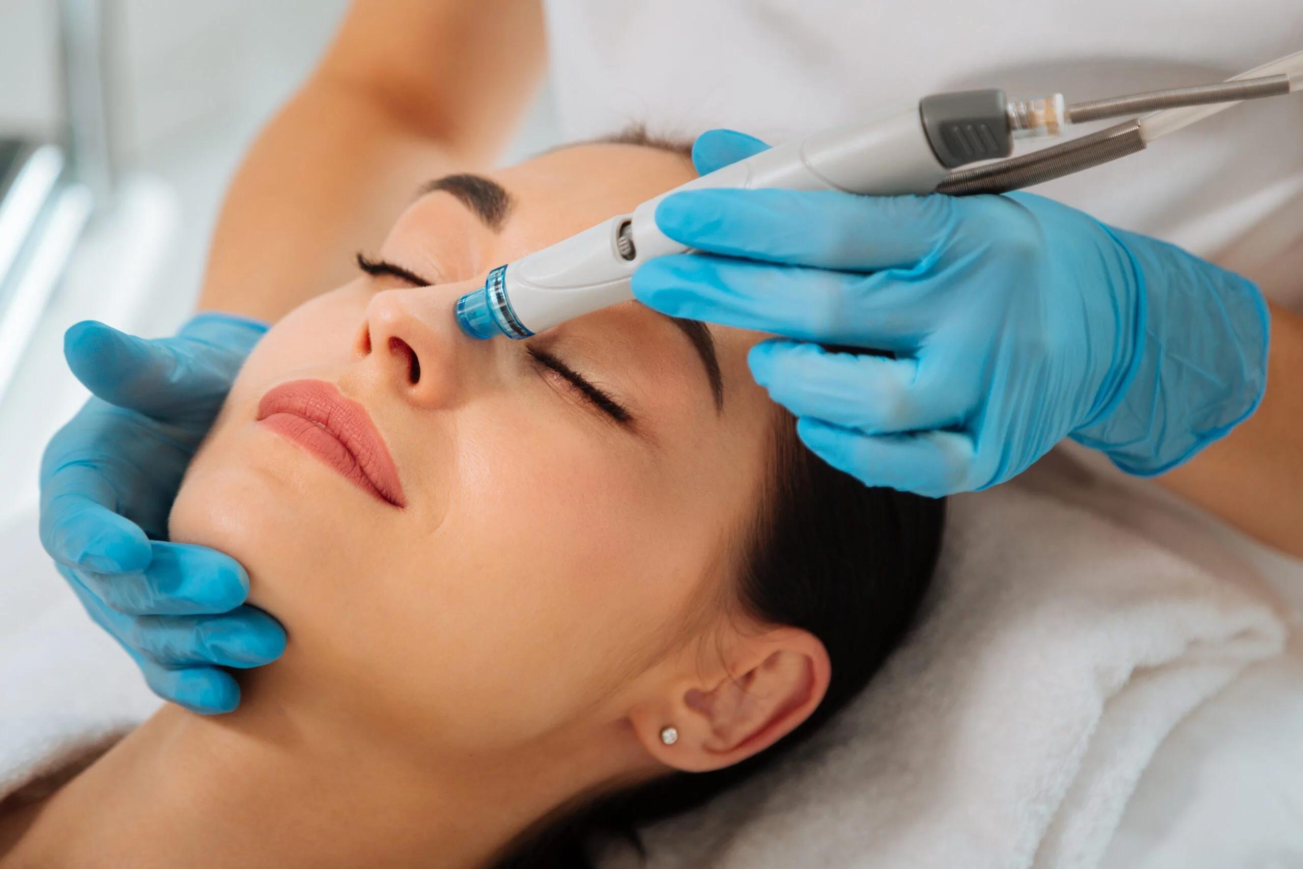 The Non-Surgical Facelift: Everything You Need to Know About PDO Threads