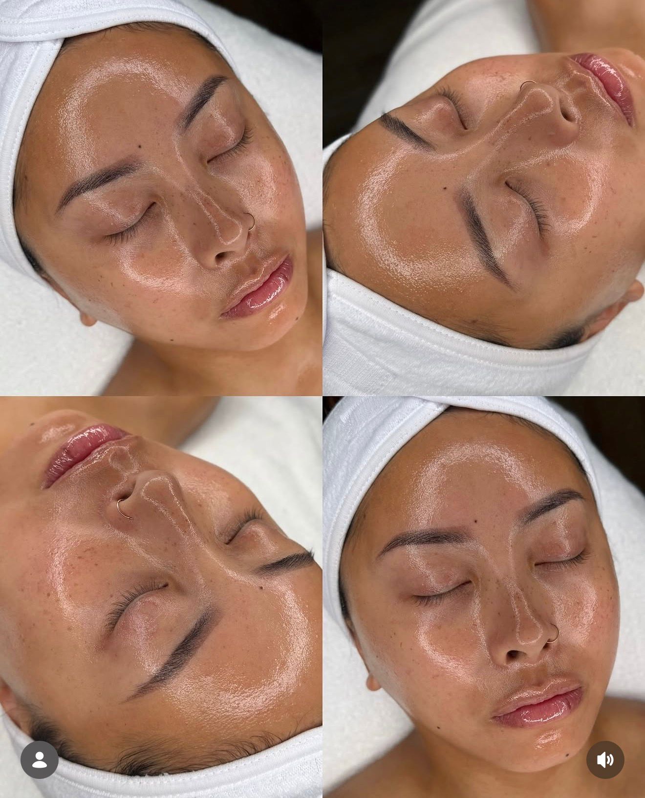 Why the Hydro Facial is the Secret to Red Carpet Skin