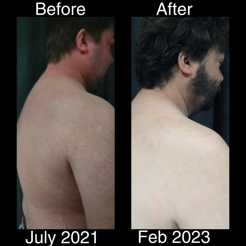 Metabolic success transformation 1