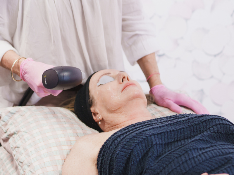 Venus Viva Skin Resurfacing
