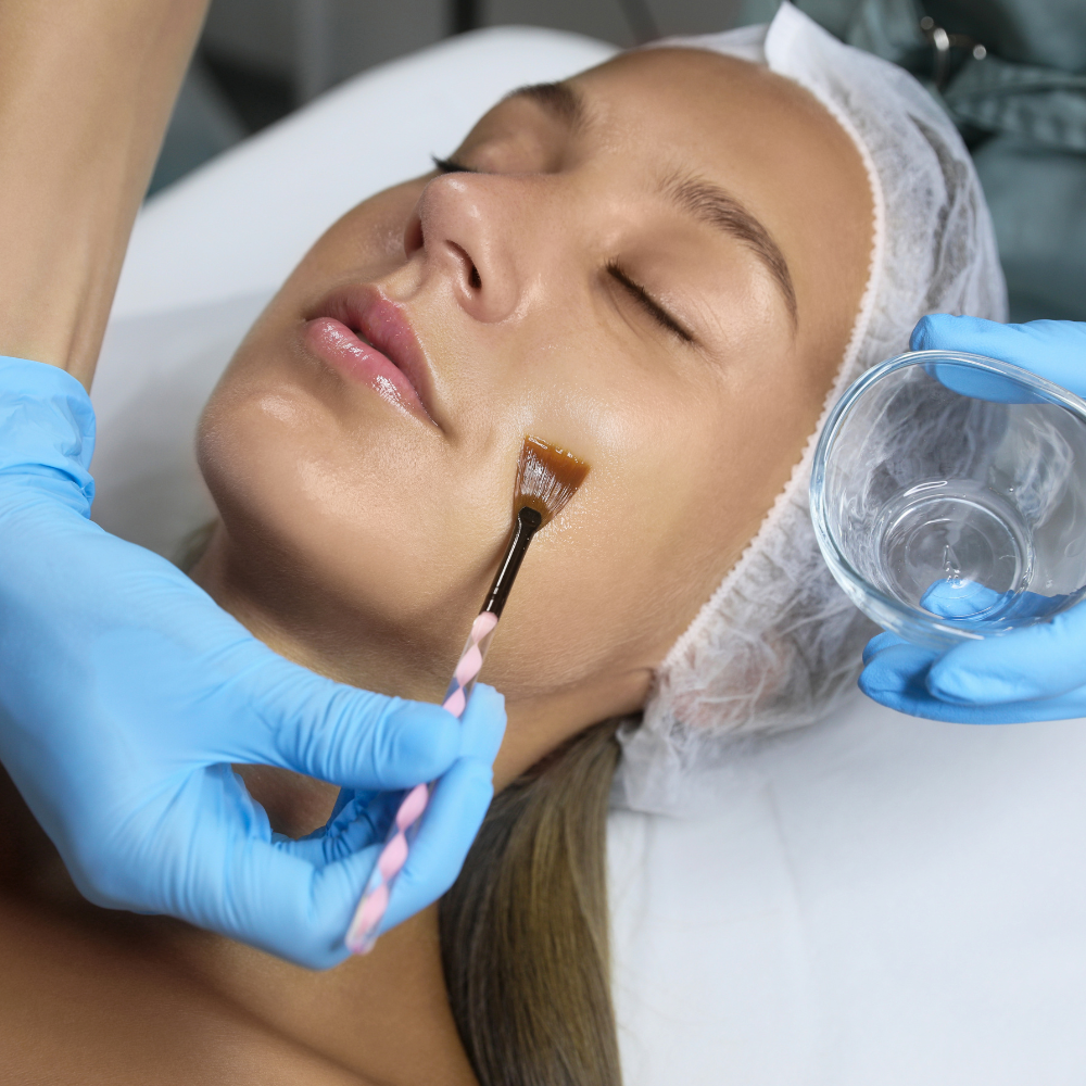 Chemical Peels treatment at Ablaze Aesthetics in Union, KY