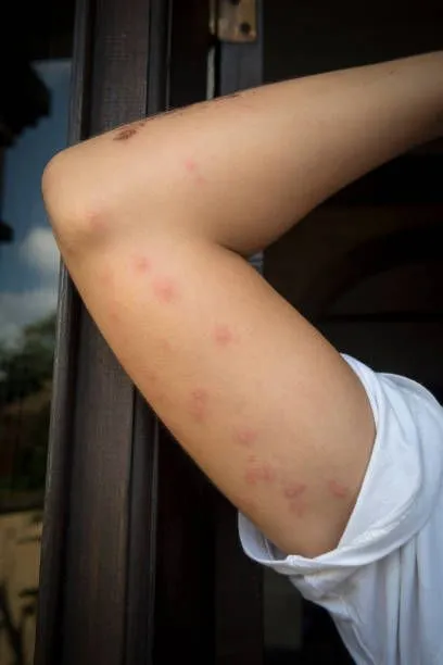 Family resting comfortably after professional bed bug treatment