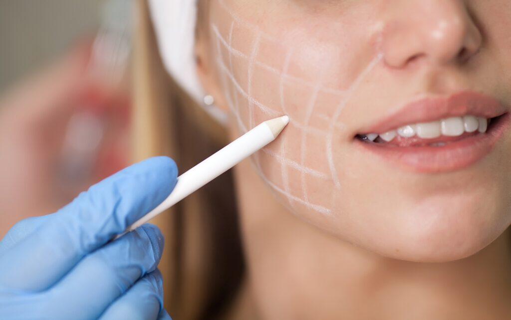 PRF Facial