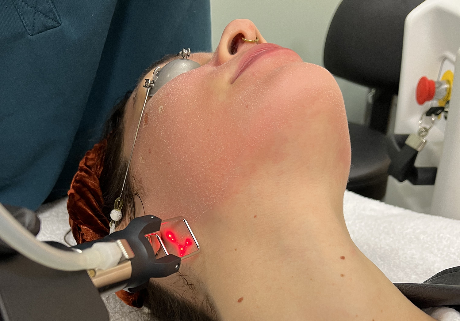 CoolPeel Full Face & Neck