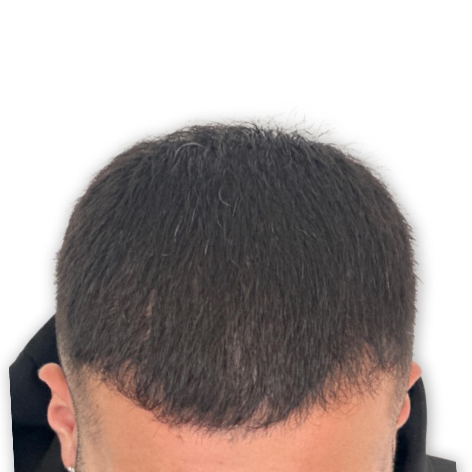 After