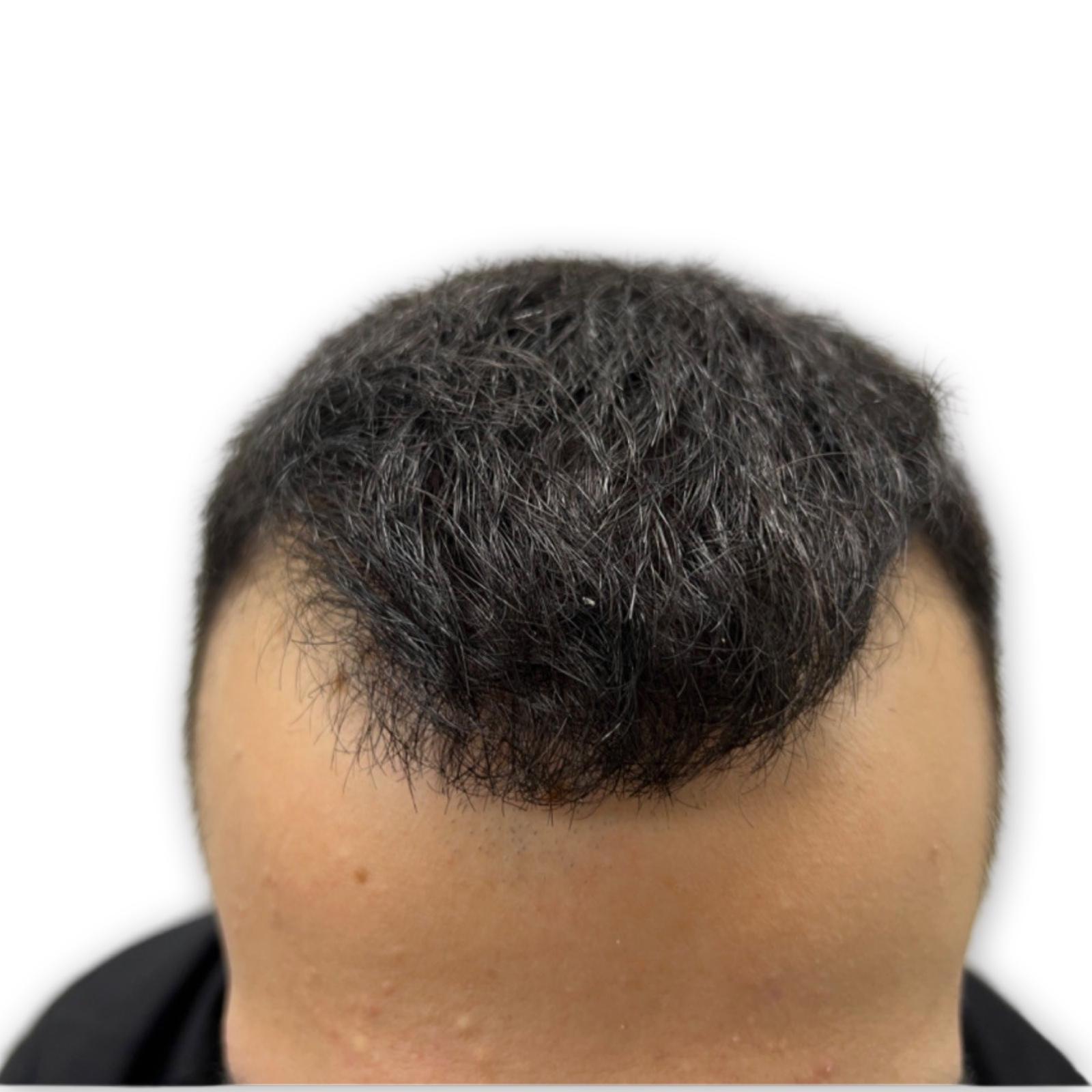 Before