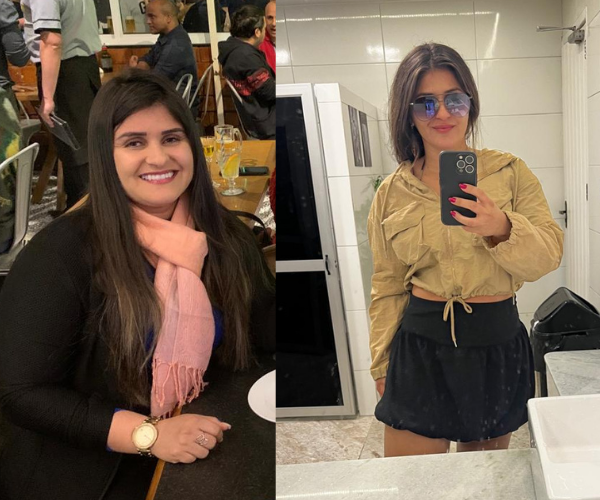 Antes e Depois de Rejane
