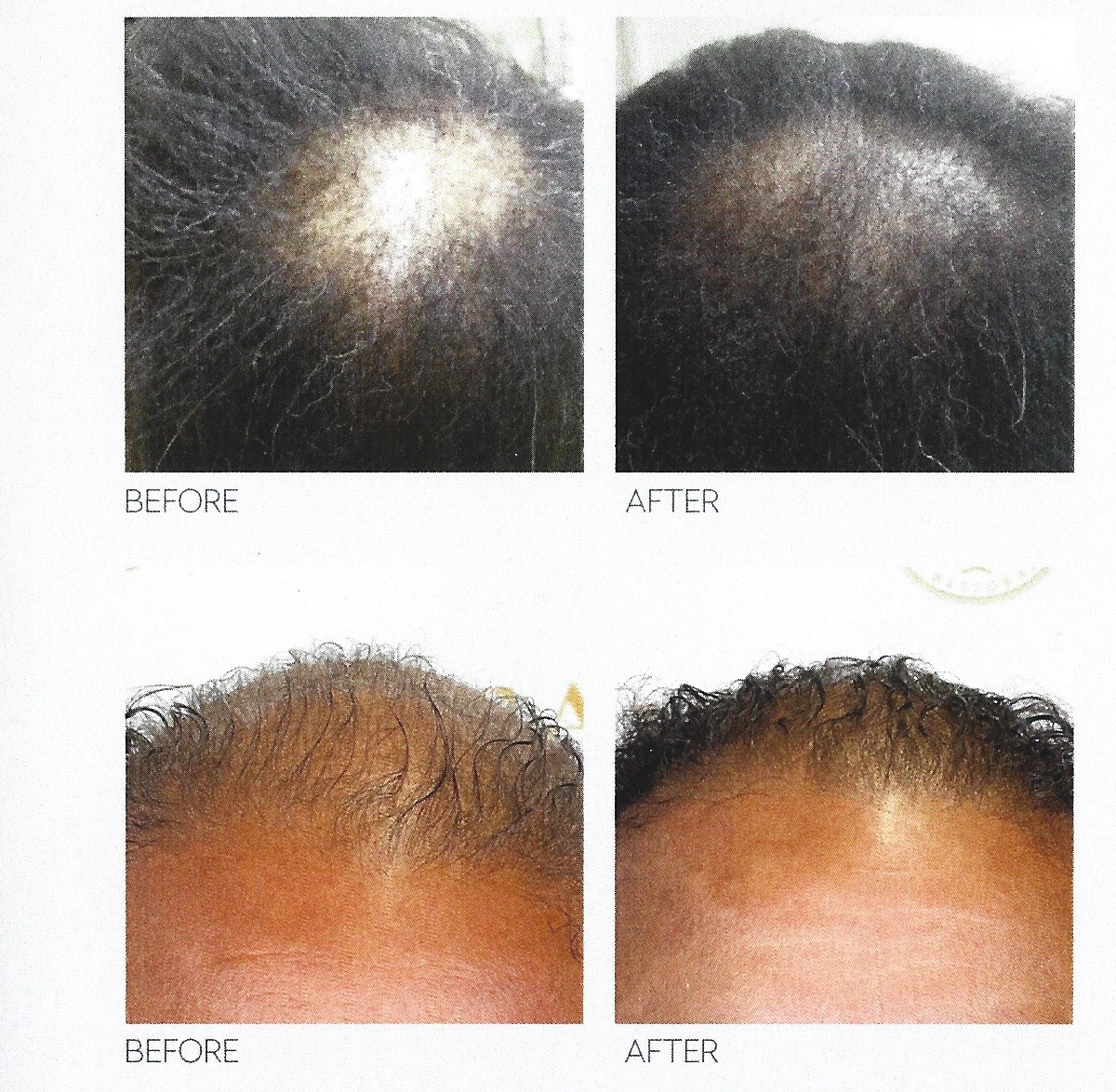 Before and After Results