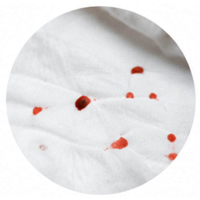 Blood spots
on sheets