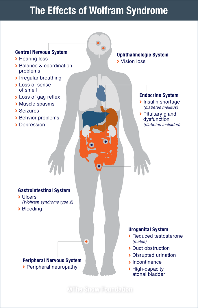 The effects of Wolfram Syndrome body diagram