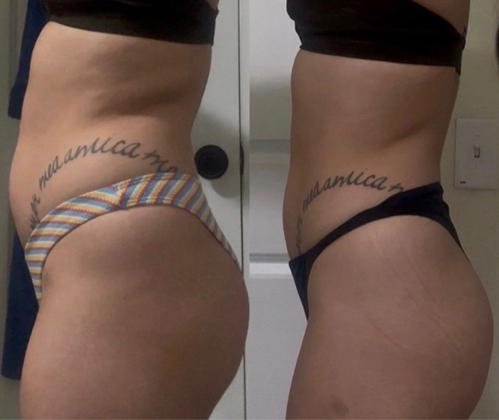 Member Transformation 4