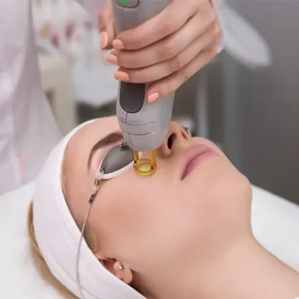 Laser Treatments