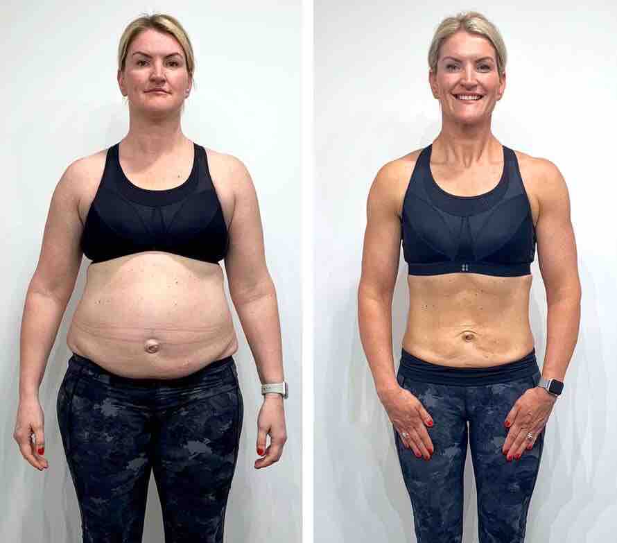 Semaglutide Weight Loss Results