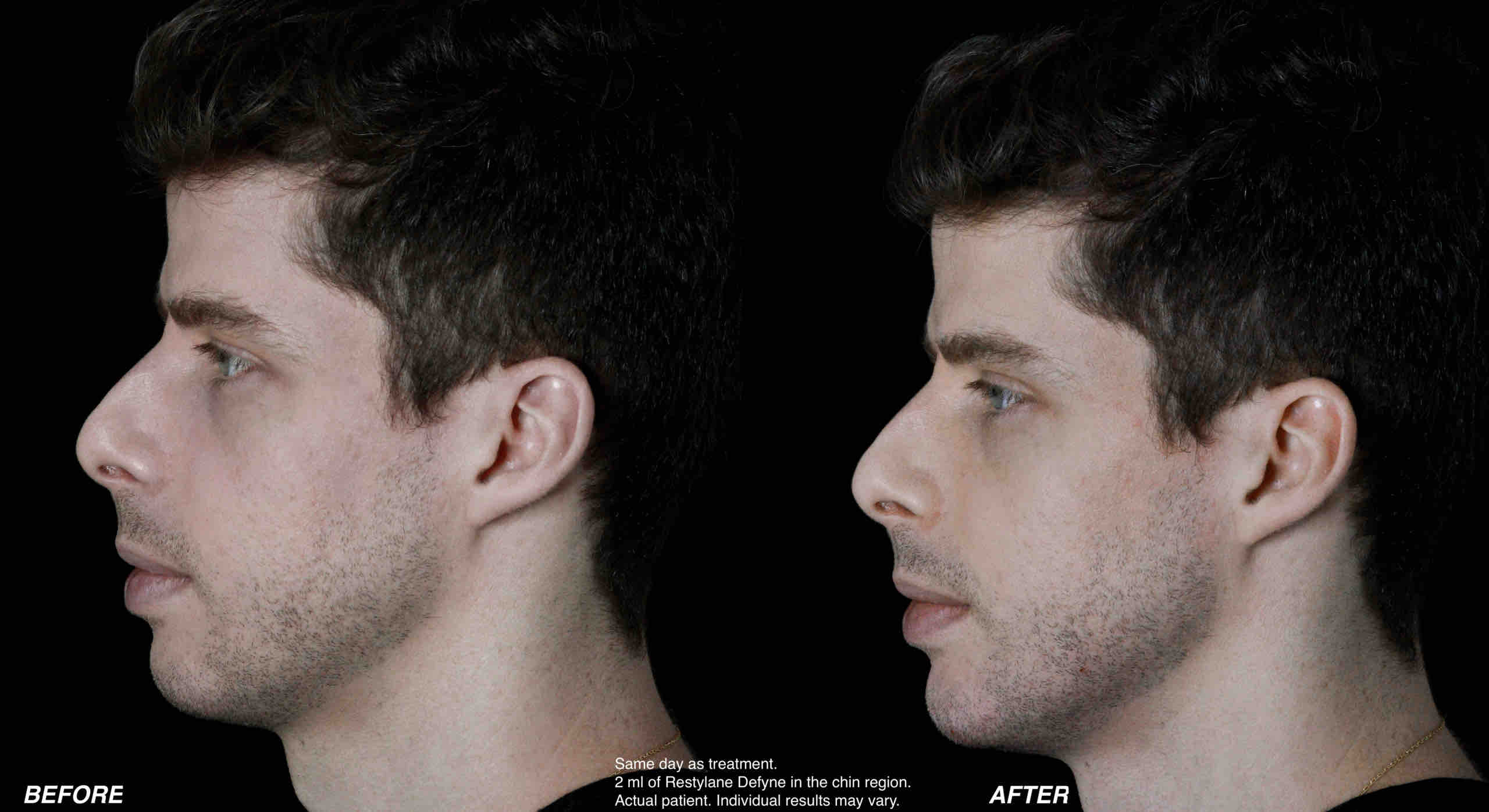 Men's aesthetic treatments at Advanced Aesthetics Medical Spa Overland Park KS