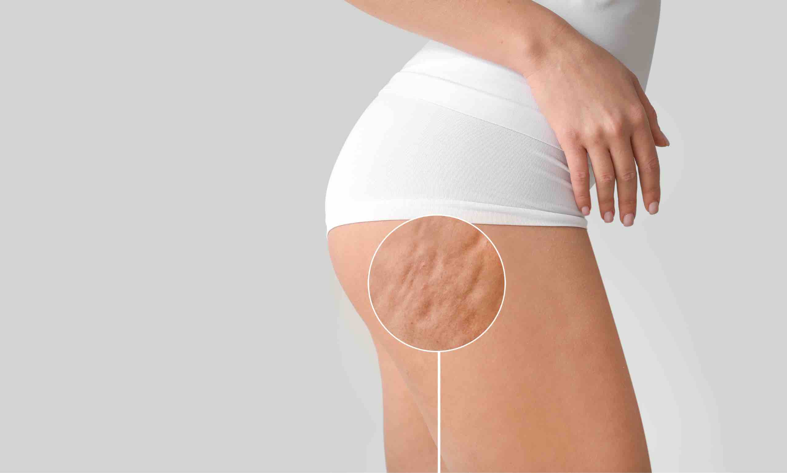 RF body tightening treatment at Advanced Aesthetics Medical Spa Overland Park KS