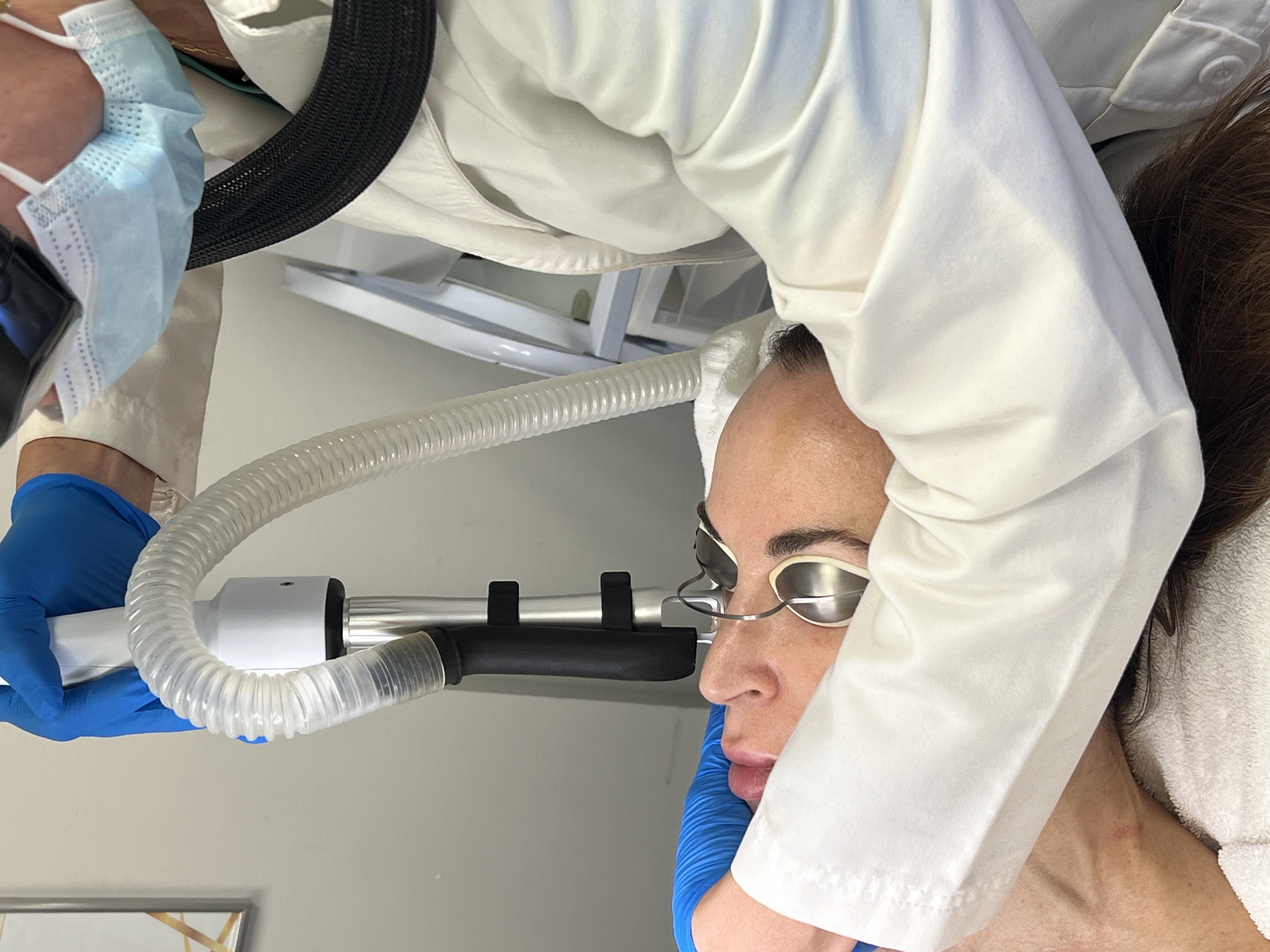 Acne laser treatment results at Advanced Aesthetics Medical Spa in Overland Park KS