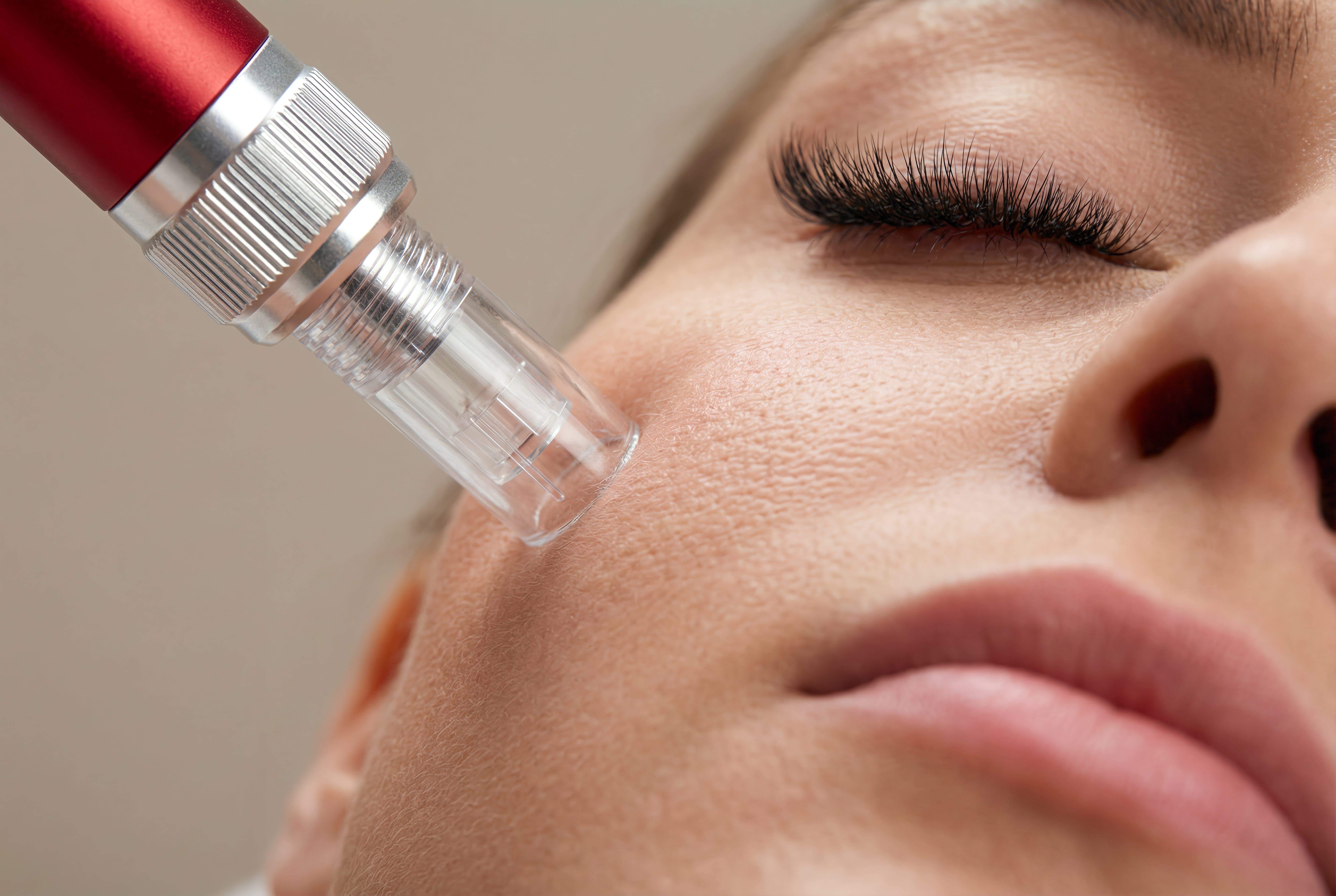 Exosome microneedling treatment at Advanced Aesthetics Medical Spa Overland Park KS