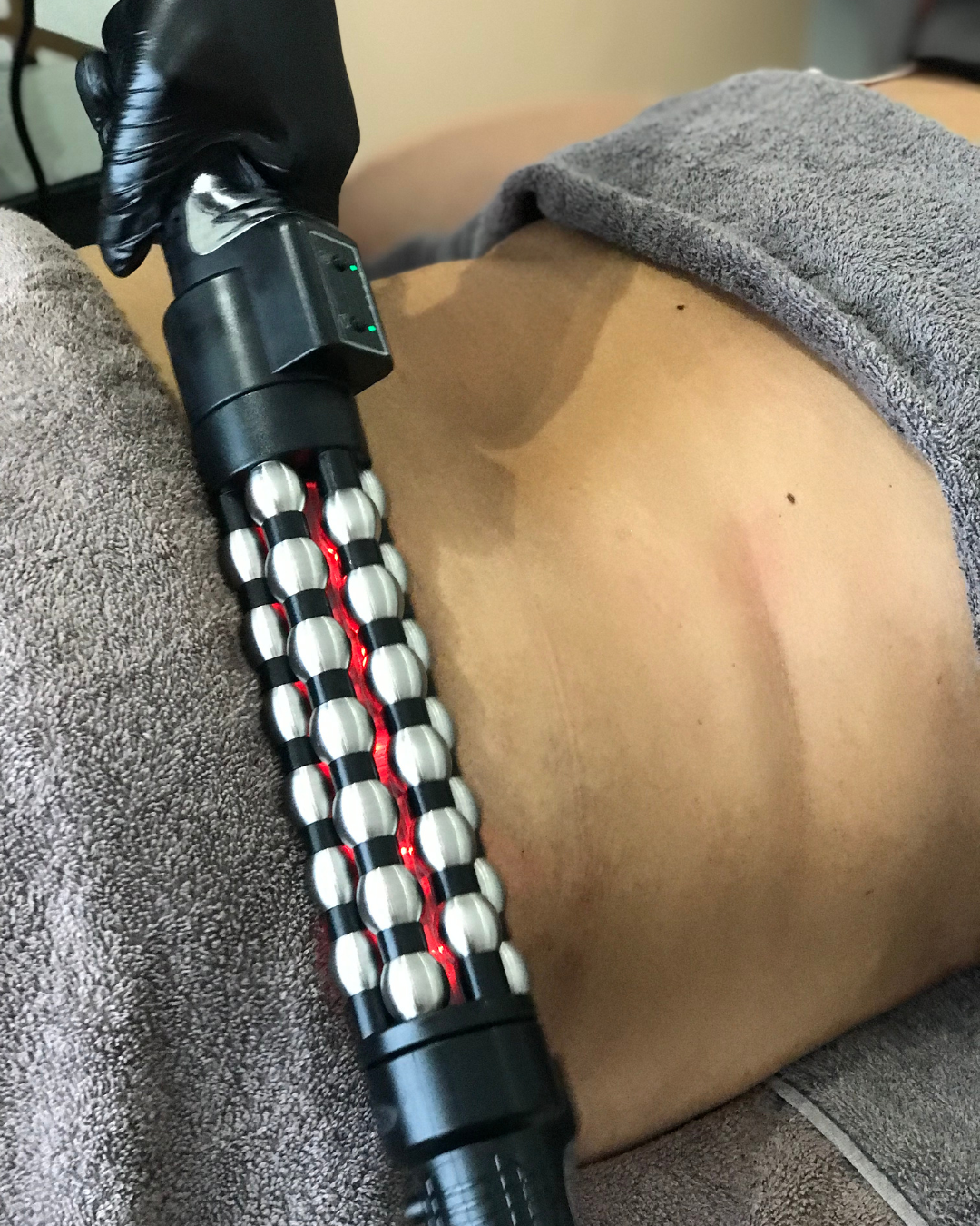 Red Light Roller Therapy